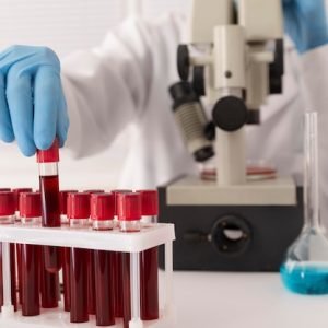 coronavirus-blood-samples-arrangement-lab_23-2149107259